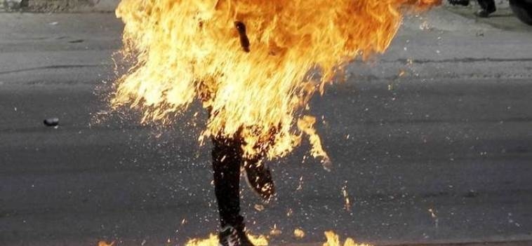 شاب يضرم النار في جسده بالشلف الجزائرية
