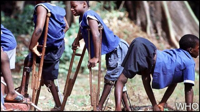 شلل الأطفال..منظمة الصحة العالمية تدق ناقوس الخطر