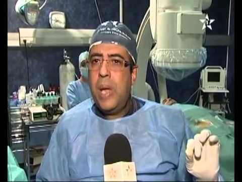 أول عملية جراحية لنبضات القلب بالمغرب