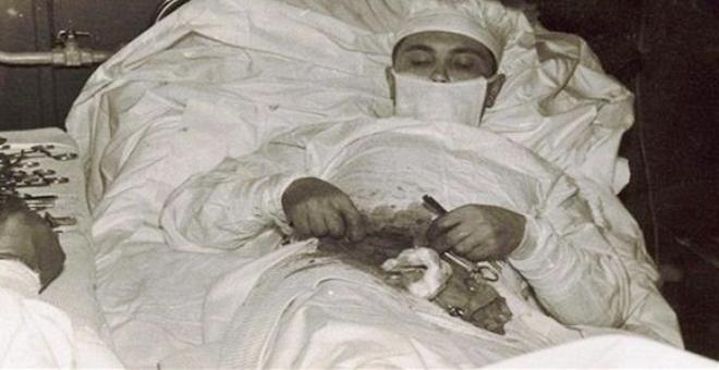 جراح روسي يستأصل زائدته الدوديّة بنفسه