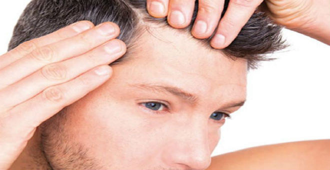 للرجل: طريقة جديدة لزراعة الشعر في ساعة واحدة