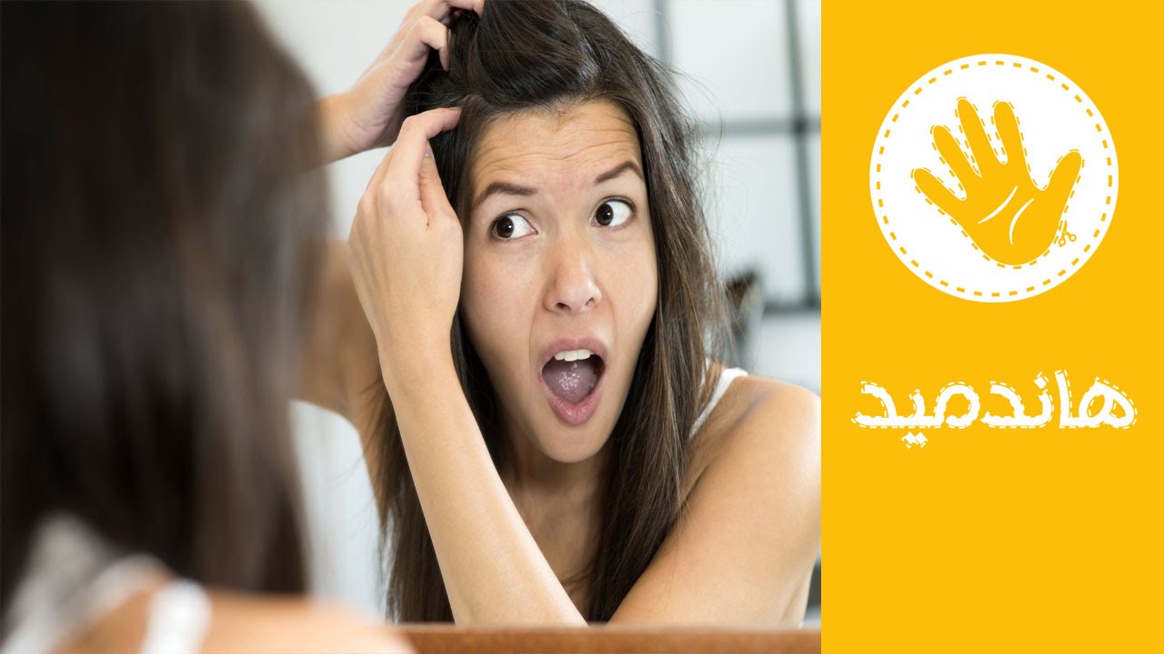 3 طرق طبيعية للتخلص من قشرة الشعر نهائيا