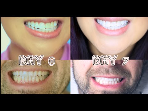 4 طرق طبيعية لأسنان بيضاء كاللؤلؤ