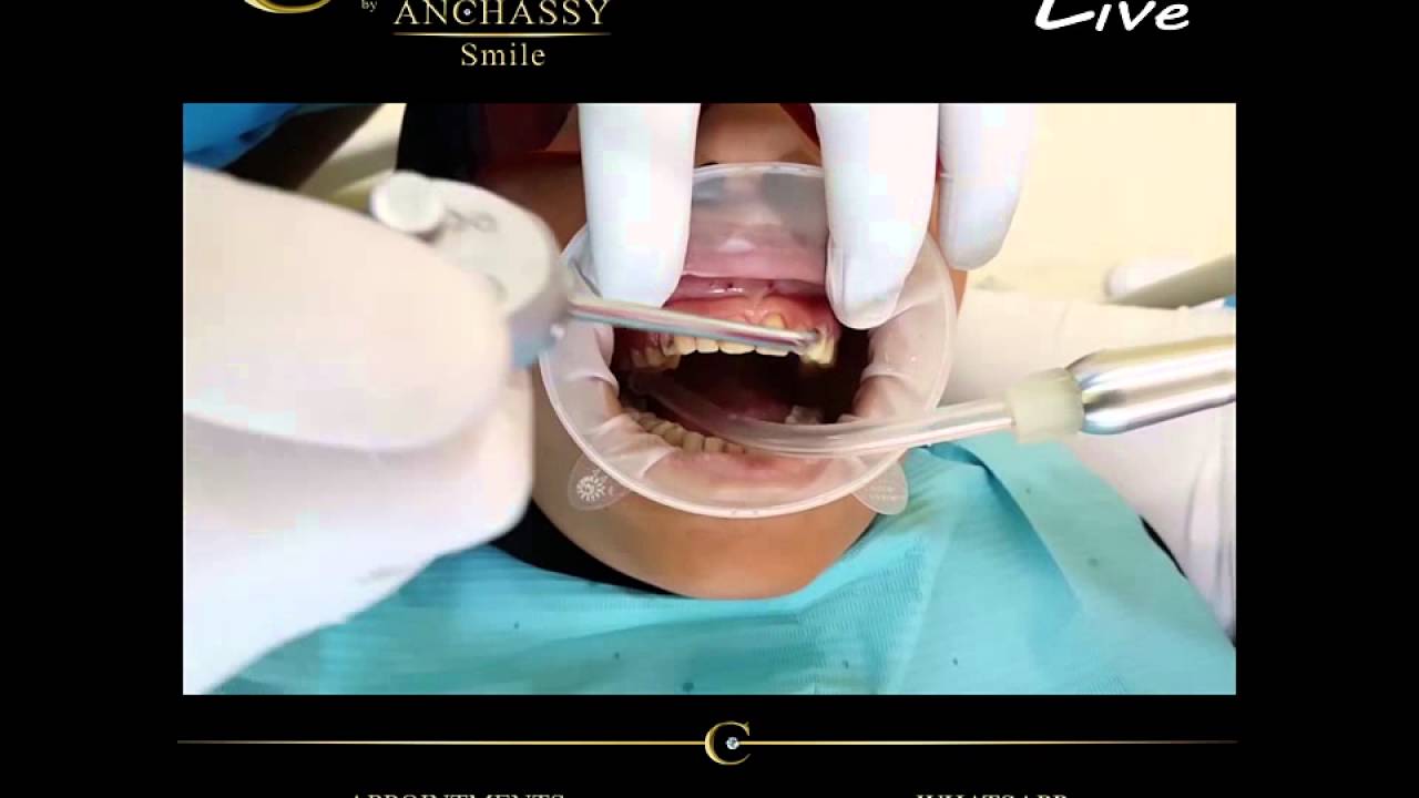بالفيديو.. طريقة ساحرة للظهور بأسنان لامعة
