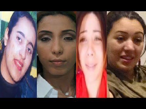 شاهد النجمات المغربيات قبل و بعد عمليات التجميل