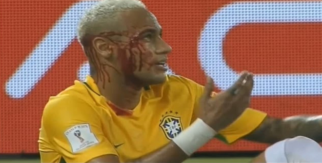 بالفيديو.. لحظة إصابة نيمار خلال مباراة منتخب بلاده أمام منتخب بوليفيا