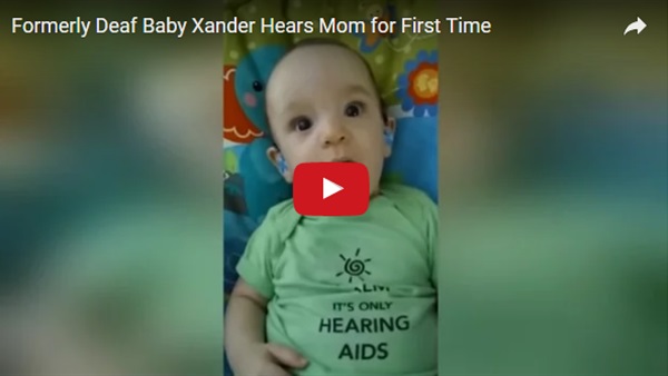 فيديو مدهش لطفل أصم يسمع صوت والدته لأول مرة !!