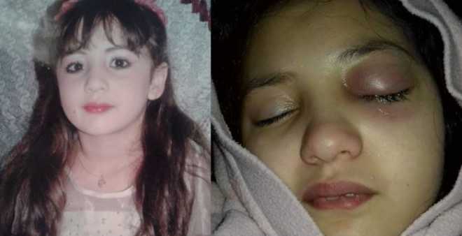 قضية الطفلة هبة.. الشرطة تطلق سراح المعلمة بسبب تأخر نتائج التشريح
