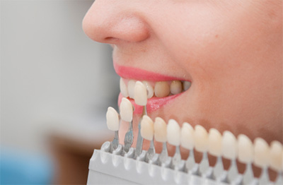 أطباء الأسنان يدعون المغاربة للتصالح مع أفواههم ويطلبون ''تغطية'' أفضل
