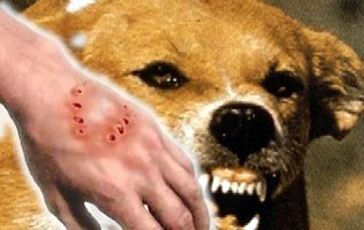 وزارة الصحة تطمئن ساكنة الرحامنة بعد عضة كلب مسعور