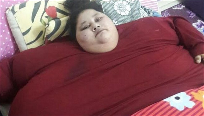 وفاة المصرية إيمان “أسمن امرأة في العالم” في مستشفى بالإمارات