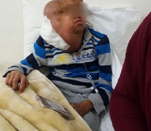 حملة فايسبوكية لإنقاذ طفل يعاني ورما في الرأس