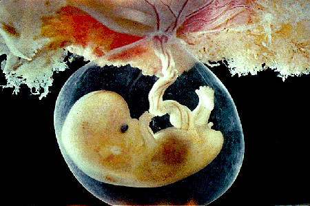 الإجهاض دراسة فقهية مقاصدية