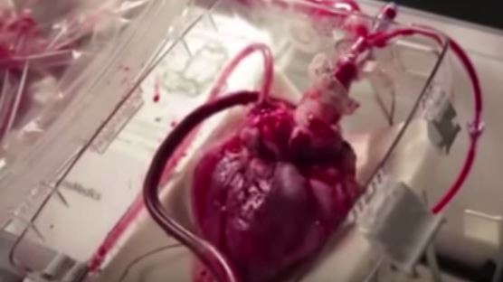 بالفيديو. قلب طبيعي ينبض للمرة الأولى خارج الجسم البشري!