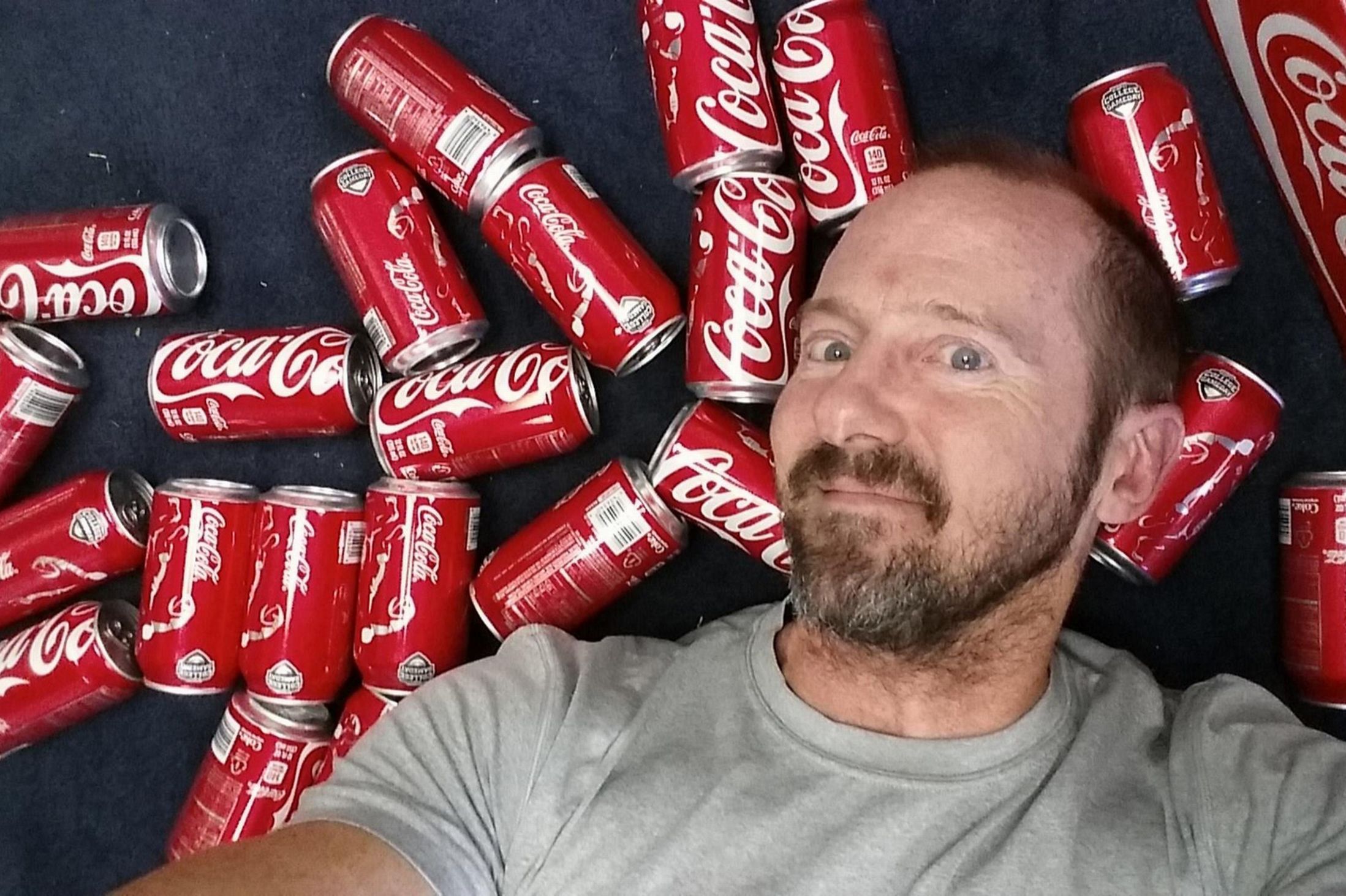 أمريكي في ال50 من عمره يشرب الكوكاكولا يوميا.. وهذه هي النتيجة..