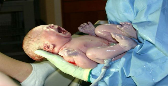 الطفل المعجزة ..جنين يولد بعد 55 يوما من وفاة أمه