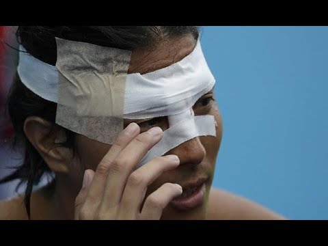 مباراة كرة الماء النسائية تتحول إلى حصة ملاكمة وضرب وجرح في اولمبياد ريو.