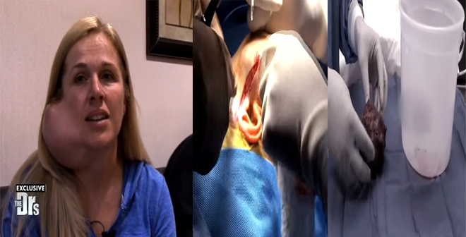 بالفيديو.. كانت تعاني انتفاخاً في وجهها.. شاهد ماذا وجد الأطباء!