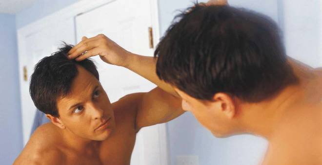 دراسة حديثة تؤكد أن زراعة الشعر تزيد الرجل جاذبية وتظهره أصغر سنا