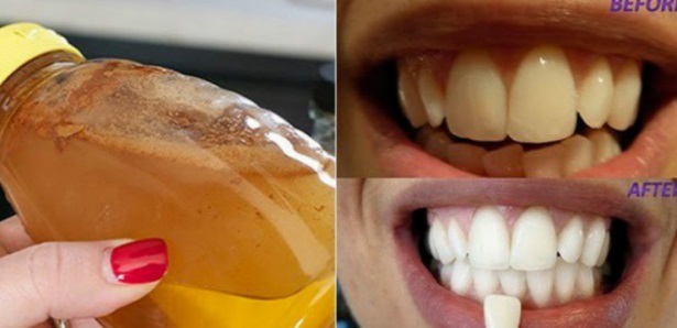 استخدموا هذه المادة فقط للمضمضة.. وهذا ما سيحصل لأسنانكم!