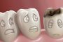 أخطاء يجب تجنبها للحفاظ على سلامة الأسنان