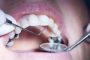 دراسة تكشف معلومة خطيرة عن الحشو المعدني للأسنان