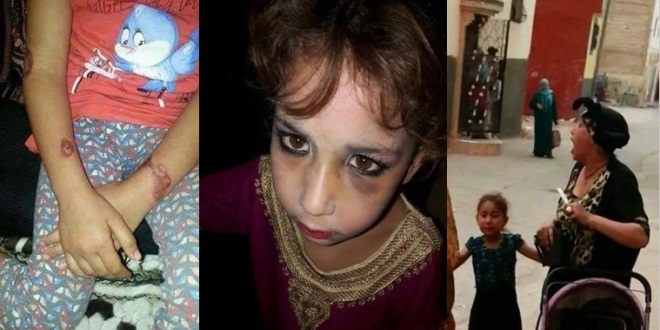 أكادير.. حملة فايسبوكية لإنقاذ طفلة من عنف والدتها المدمنة