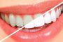 اكتشاف مادة بمفعول سحري لتبييض الاسنان بصورة آمنة
