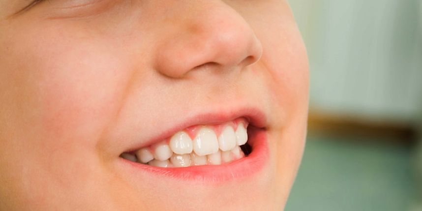 8 نصائح لحماية أسنان الأطفال