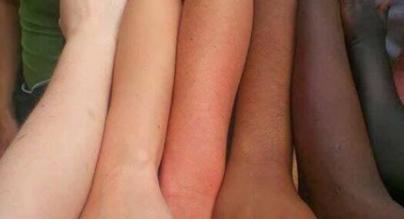 دراسة جديدة تفجر مفاجأة حول لون البشرة!