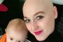 بعد علاج كيماوي واستئصال ثدي.. سيدة تكتشف خطأ تشخيصها بالسرطان