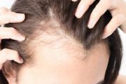 طرق إنبات الشعر في مقدمة الرأس طبيعيا