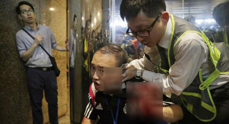 انفصلت تماما عن رأسه.. فيديو: رجل يقضم أذن متظاهر في هونج كونج