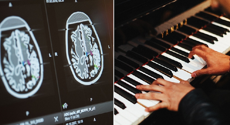 مريض يعزف 'البيانو' أثناء إجراء جراحة في دماغه