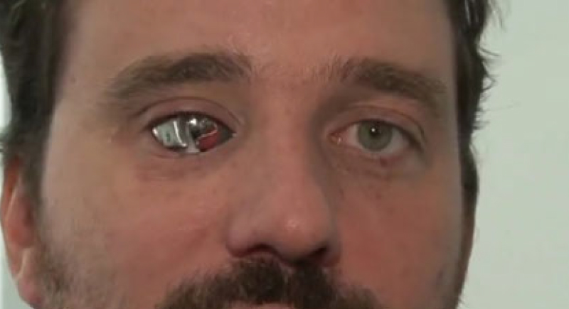 فيديو.. شاب يحول عينه إلى كاميرا تصوير بعد فقدان بصره