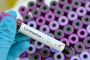 الصين: العثور على فيروس كورونا في السائل المنوي