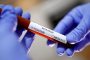 وزارة الصحة تعلن تسجيل 92 حالة إصابة جديدة بفيروس كورونا