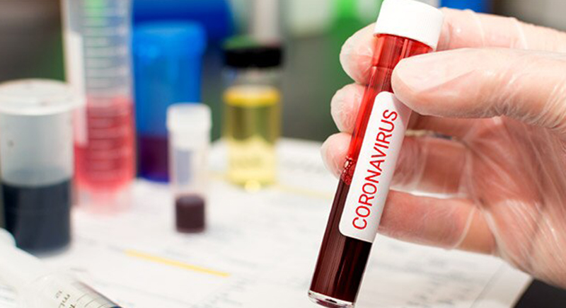 علماء: فيروس كورونا يبقى في الجسم لأكثر من شهر بعد الإصابة به