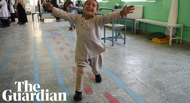 بالفيديو.. طفل يبهر الجميع برقصه فرحا لحصوله على ساق صناعية جديدة