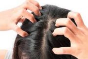 5 وصفات طبيعية تخلصك من قشرة الشعر نهائيا
