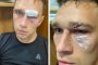 لاعب روسي يعتدي بالضرب المبرح على حكم أشهر في وجهه بطاقة حمراء (فيديو)