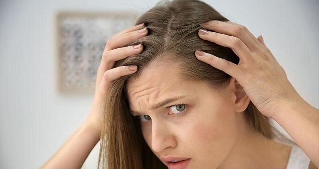 وصفات طبيعية لعلاج قشرة الشعر