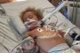 الصغار أمام مرمى كورونا.. طفل يدخل في غيبوبة 6 أيام بعد إصابته بالفيروس