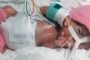 ولادة أصغر طفل في العالم بعد الحمل بـ 5 أشهر .. 