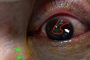 إصابة رجل بقطع في قرنية العين بسبب الكمامة