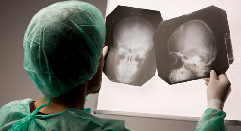 طفلة تدخل المستشفى بـ”كسر في الجمجمة” لتستيقظ وهي تتحدث الإنجليزية بطلاقة