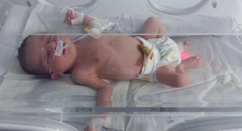 ولادة طفل سليم لمريضة مصابة بكورونا: 