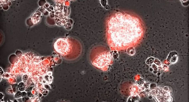 توثيق لحظة هجوم فيروس كورونا على خلايا الدماغ (فيديو)