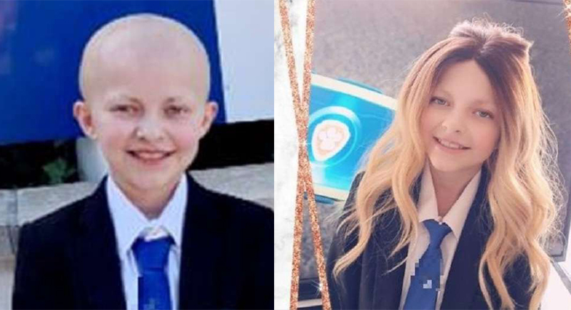 لم تعد ترغب في الذهاب للمدرسة.. طفلة بريطانية تتعرض للتنمر بعد سقوط شعرها بسبب السرطان