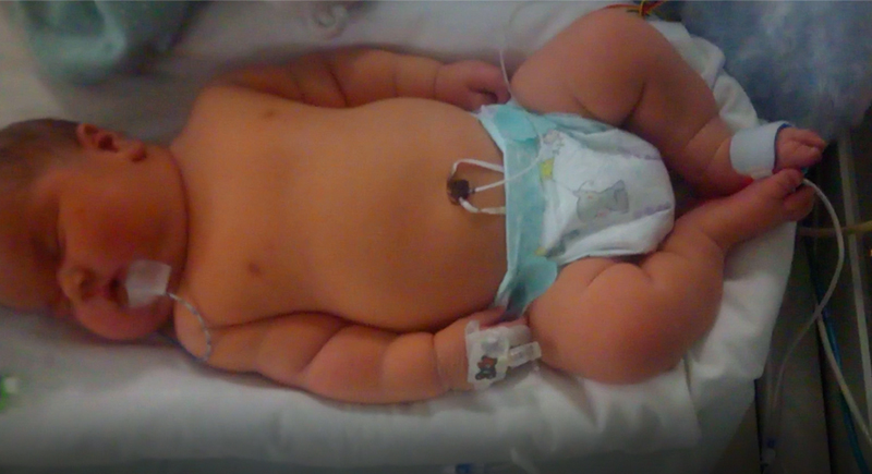 العاملين في المستشفى صُدِموا ..ولادة ثالث أكبر طفل في تاريخ بريطانيا